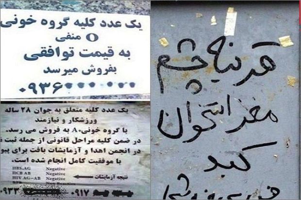 iranli-gencler-ehtiyac-uzunden-daxili-orqanlarini-satmaq-mecburiyyetinde-qalirlar-foto